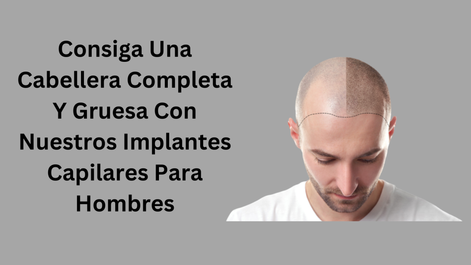 implantes de pelo para hombres